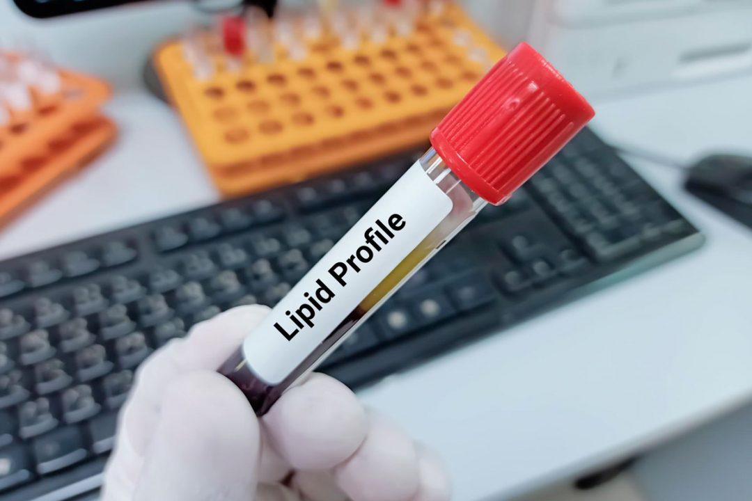 ≡ Comment Lire les Résultats d