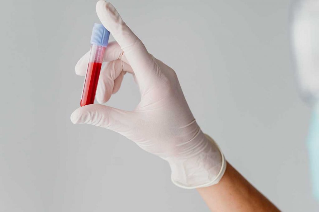 ≡ Gamma GT Taux Elevé, Bas, Risques et Solutions Décryptage