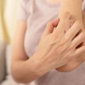 L’urticaire : comment la reconnaitre et la traiter ?