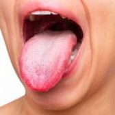 Langue blanche : causes et solutions