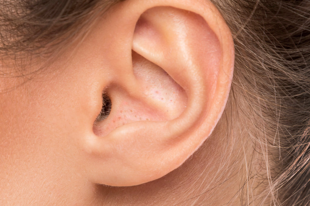 Points Noirs dans l'Oreille : Comment les Enlever ? Pourquoi ?