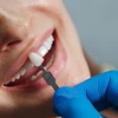 Quel prix et remboursements pour une prothèse dentaire ?