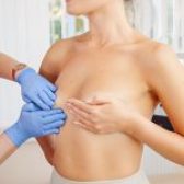 Combien coûte une augmentation mammaire ?