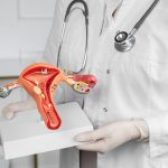 L’essentiel à savoir sur le cancer de l’ovaire